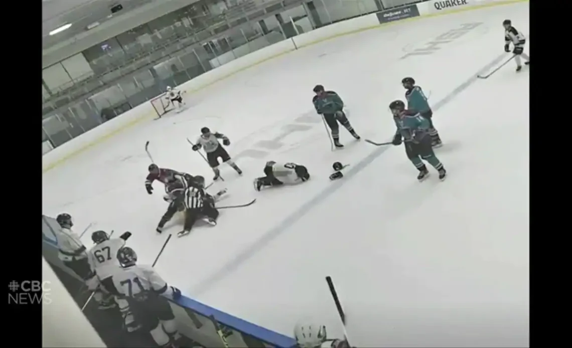 Burnaby RCMP investigates hockey player allegedly getting kicked in head with skate