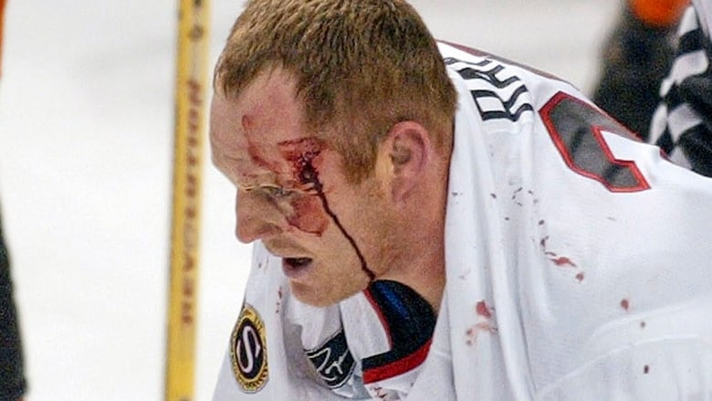 A bloodied Ottawa Senators player skates to the penalty box during a March 5, 2004 NHL game.